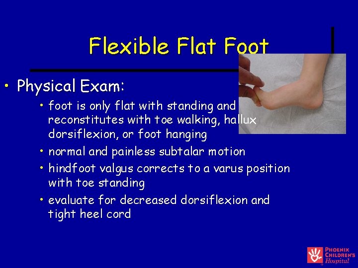 Flexible Flat Foot • Physical Exam: • foot is only flat with standing and Flexible Flat Foot • Physical Exam: • foot is only flat with standing and