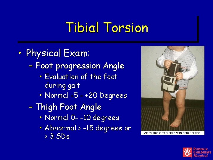 Tibial Torsion • Physical Exam: – Foot progression Angle • Evaluation of the foot Tibial Torsion • Physical Exam: – Foot progression Angle • Evaluation of the foot