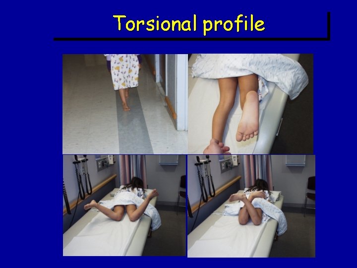 Torsional profile Torsional profile