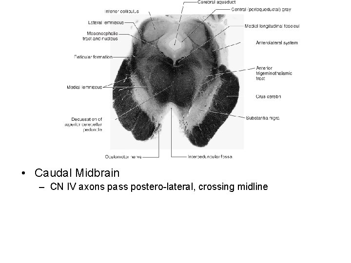 • Caudal Midbrain – CN IV axons pass postero-lateral, crossing midline 