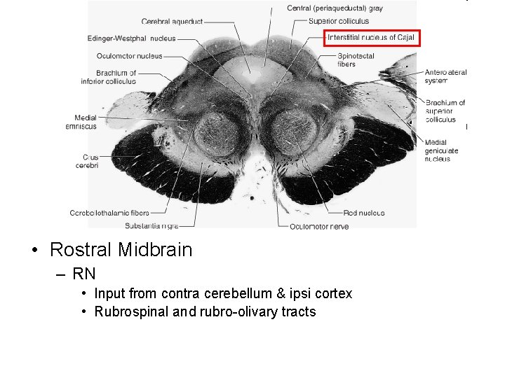  • Rostral Midbrain – RN • Input from contra cerebellum & ipsi cortex