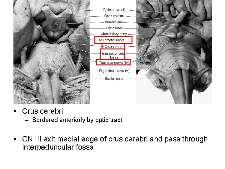  • Crus cerebri – Bordered anteriorly by optic tract • CN III exit