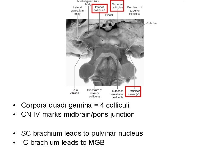  • Corpora quadrigemina = 4 colliculi • CN IV marks midbrain/pons junction •