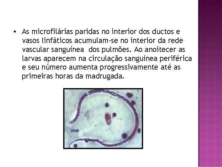  • As microfilárias paridas no interior dos ductos e vasos linfáticos acumulam-se no