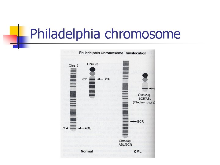 Philadelphia chromosome 