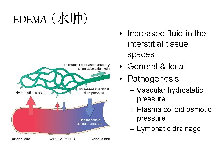 EDEMA (水肿) • Increased fluid in the interstitial tissue spaces • General & local