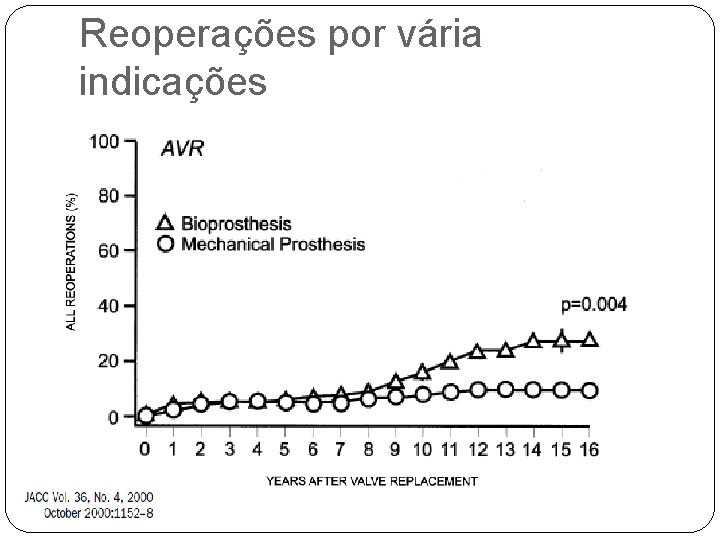 Reoperações por vária indicações 