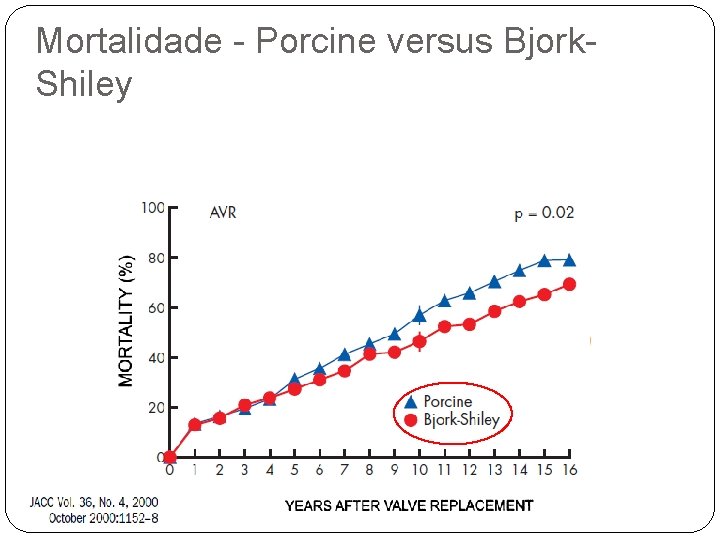 Mortalidade - Porcine versus Bjork. Shiley 