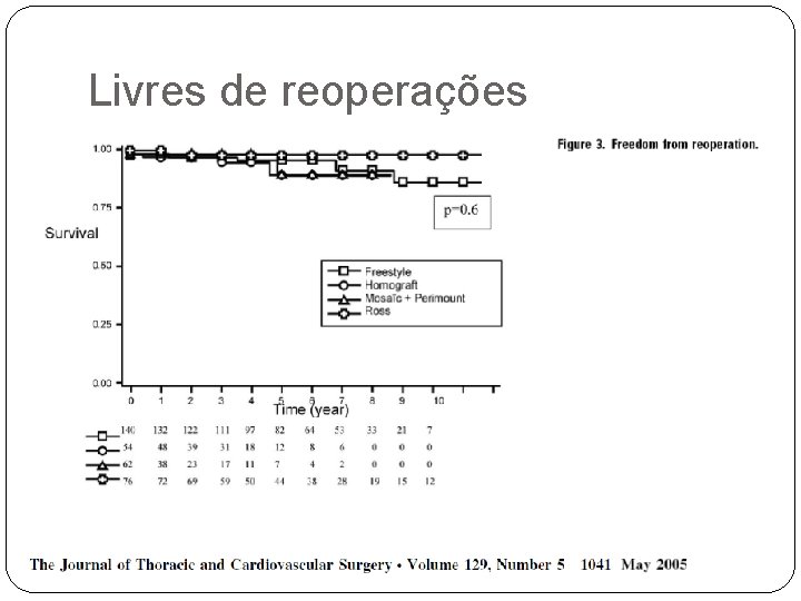 Livres de reoperações 