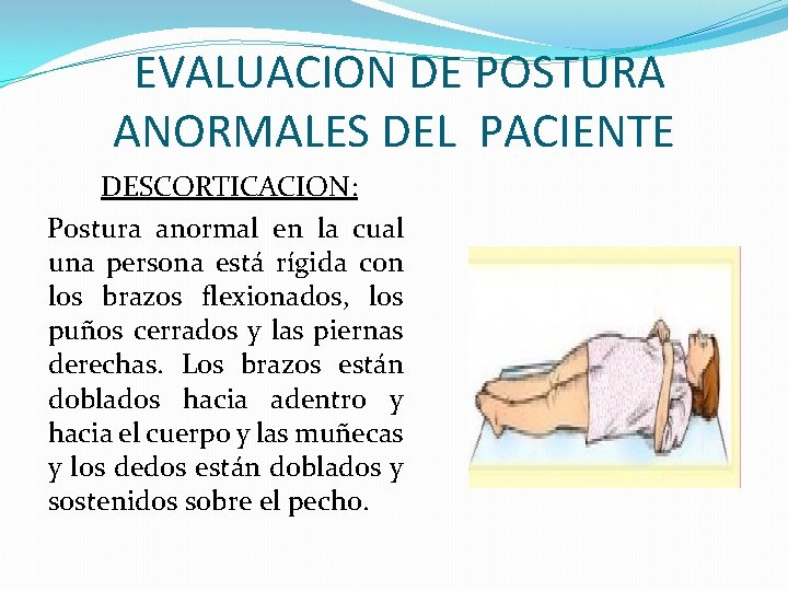 EVALUACION DE POSTURA ANORMALES DEL PACIENTE DESCORTICACION: Postura anormal en la cual una persona