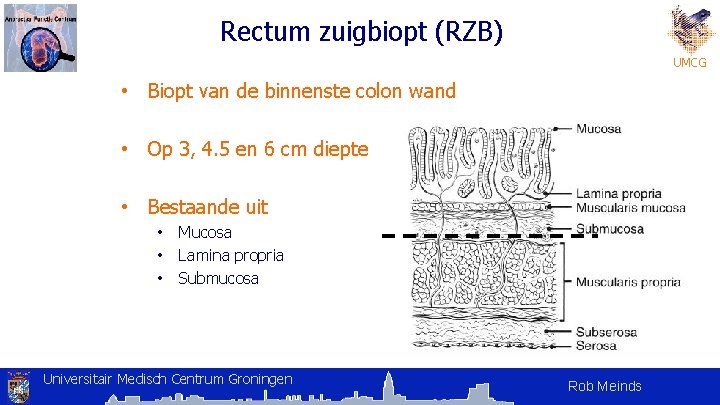 Rectum zuigbiopt (RZB) UMCG • Biopt van de binnenste colon wand • Op 3, Rectum zuigbiopt (RZB) UMCG • Biopt van de binnenste colon wand • Op 3,