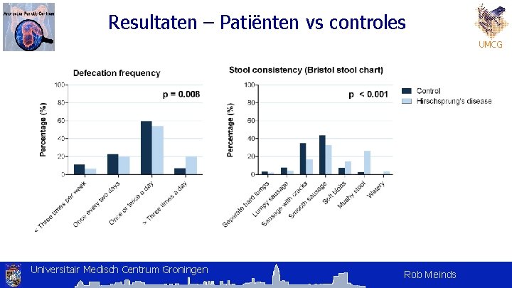 Resultaten – Patiënten vs controles UMCG Universitair Medisch Centrum Groningen Rob Meinds Resultaten – Patiënten vs controles UMCG Universitair Medisch Centrum Groningen Rob Meinds