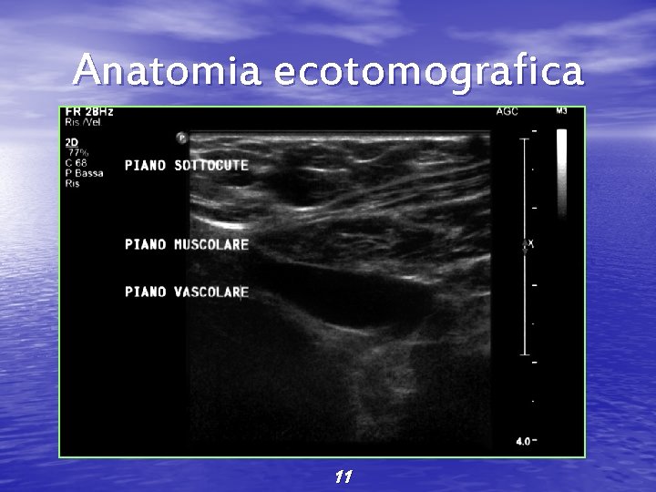 Anatomia ecotomografica 11 