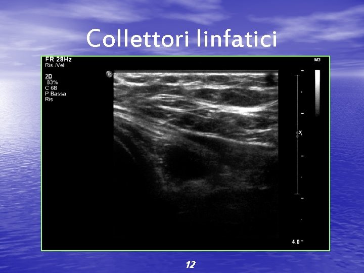 Collettori linfatici 12 