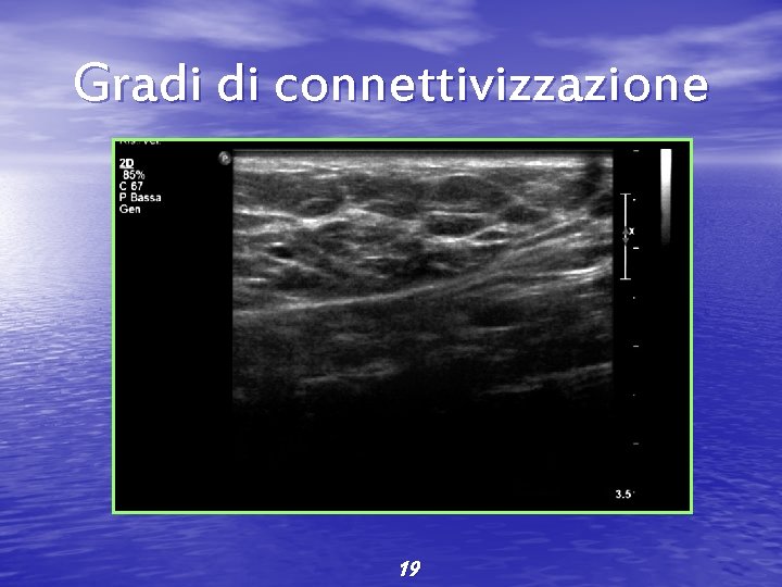 Gradi di connettivizzazione 19 