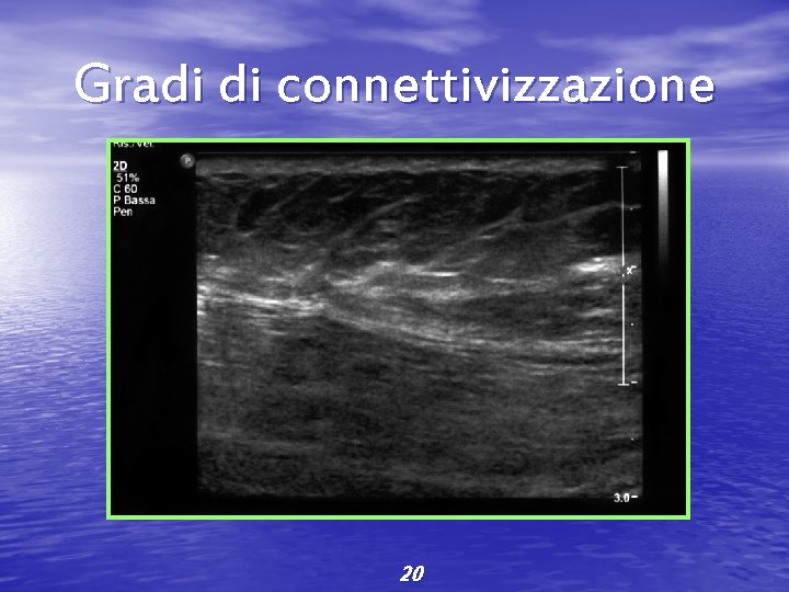 Gradi di connettivizzazione 20 