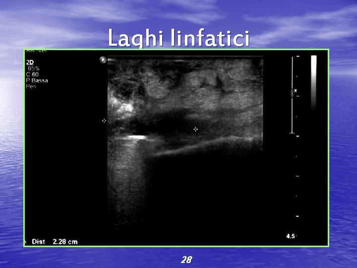 Laghi linfatici 28 