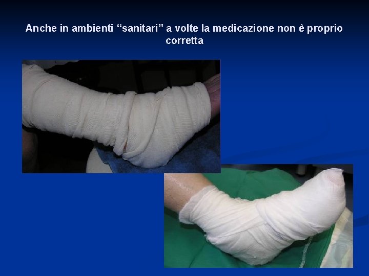 Anche in ambienti “sanitari” a volte la medicazione non è proprio corretta 