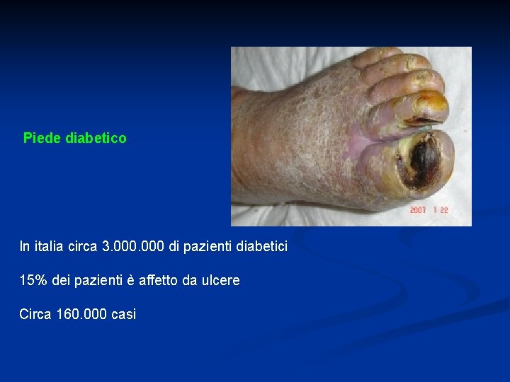 Piede diabetico In italia circa 3. 000 di pazienti diabetici 15% dei pazienti è