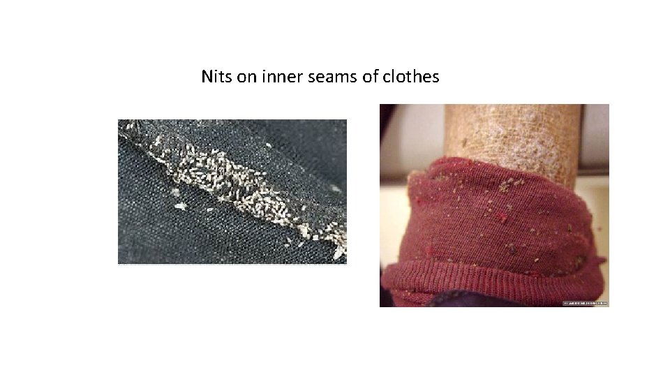 Nits on inner seams of clothes 