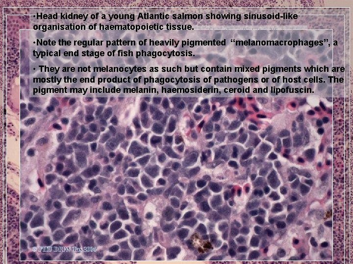 • Head kidney of a young Atlantic salmon showing sinusoid-like organisation of haematopoietic