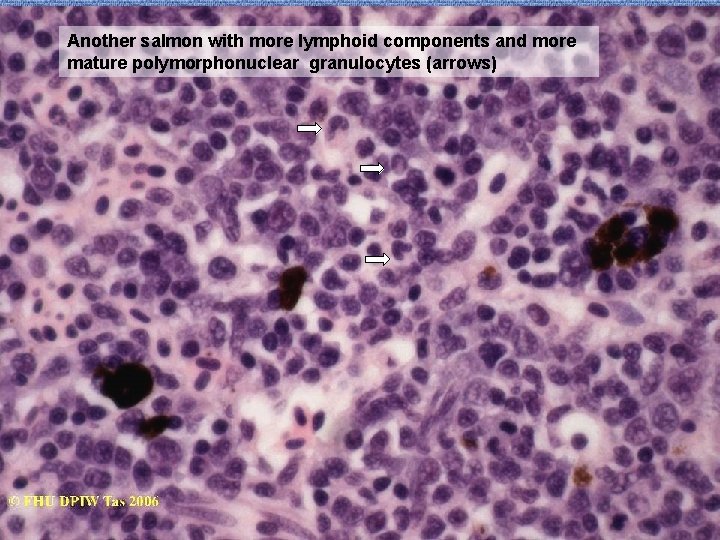 Another salmon with more lymphoid components and more mature polymorphonuclear granulocytes (arrows) 