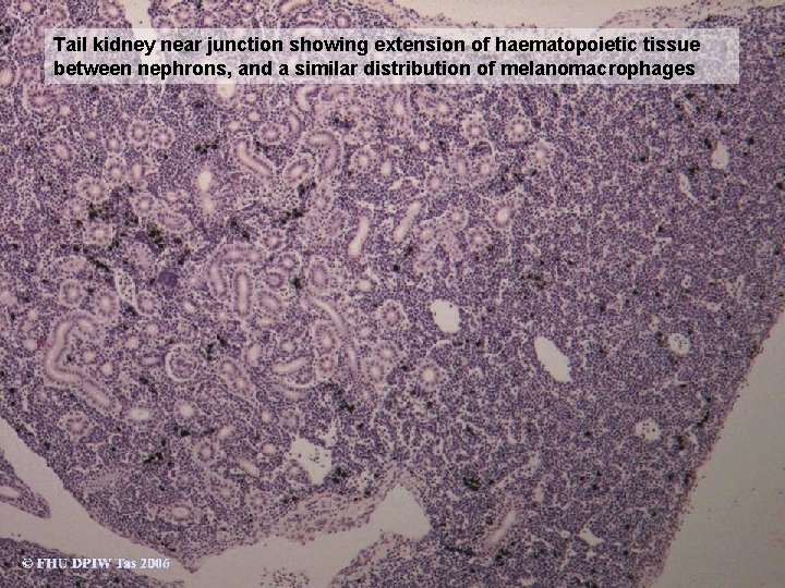 Tail kidney near junction showing extension of haematopoietic tissue between nephrons, and a similar