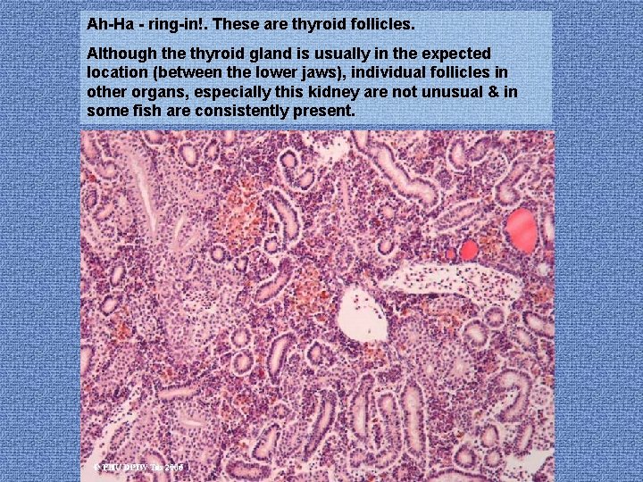 Ah-Ha - ring-in!. These are thyroid follicles. Although the thyroid gland is usually in