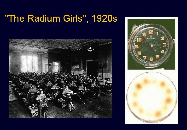 "The Radium Girls", 1920 s "The Radium Girls", 1920 s