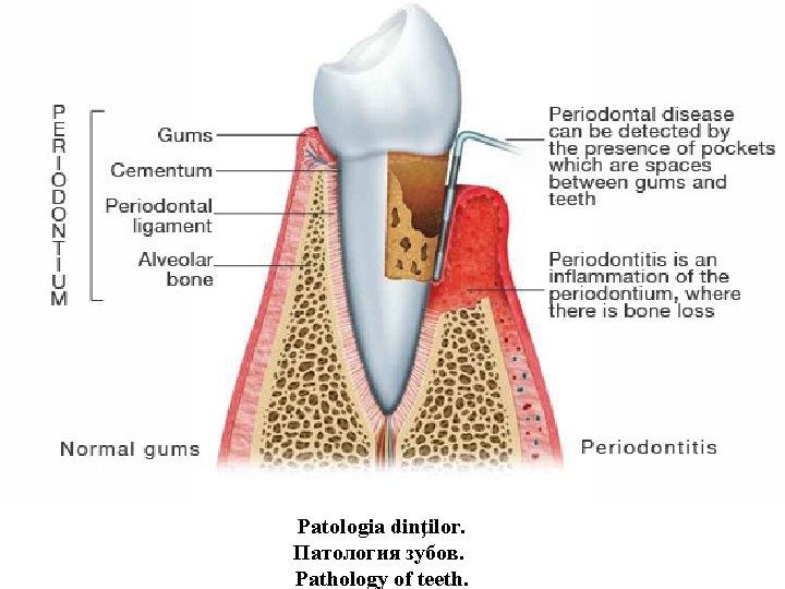 Patologia dinţilor. Патология зубов. Pathology of teeth. 