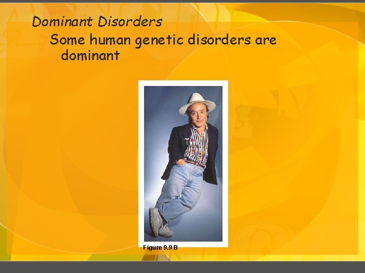 Dominant Disorders Some human genetic disorders are dominant Figure 9. 9 B 