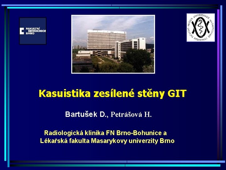 Kasuistika zesílené stěny GIT Bartušek D. , Petrášová H. Radiologická klinika FN Brno-Bohunice a