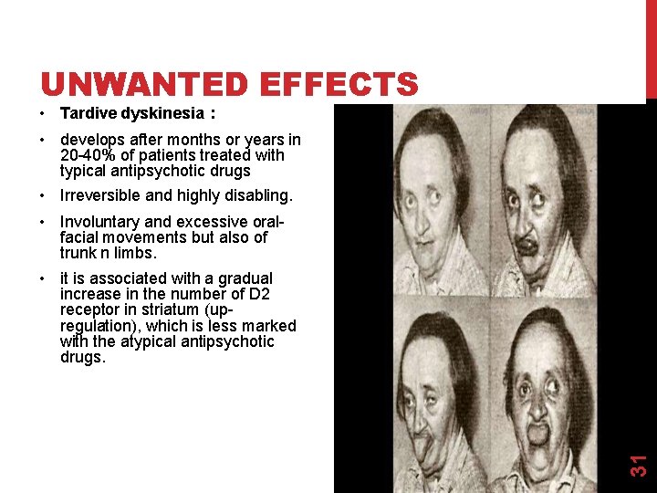UNWANTED EFFECTS • Tardive dyskinesia : • develops after months or years in 20