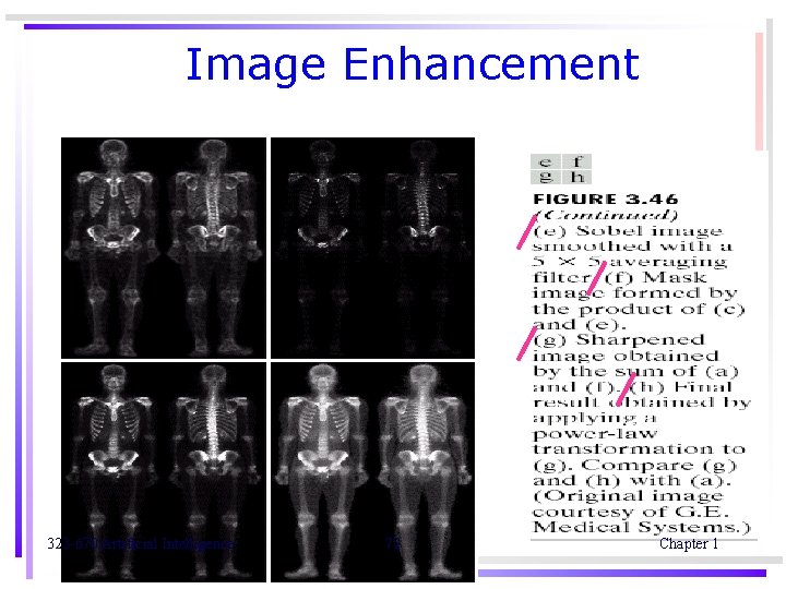 Image Enhancement 323 -670 Artificial Intelligence 72 Chapter 1 