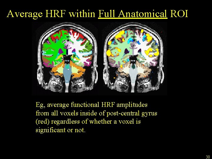 Average HRF within Full Anatomical ROI Eg, average functional HRF amplitudes from all voxels