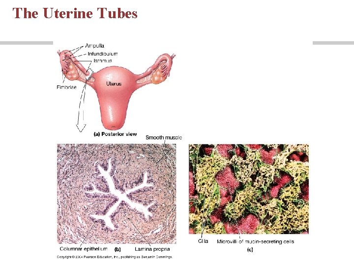 The Uterine Tubes The Uterine Tubes