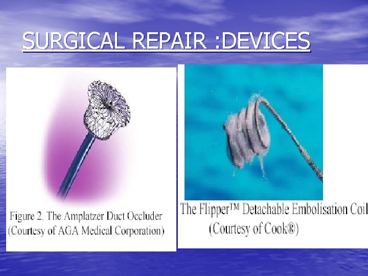 SURGICAL REPAIR : DEVICES 