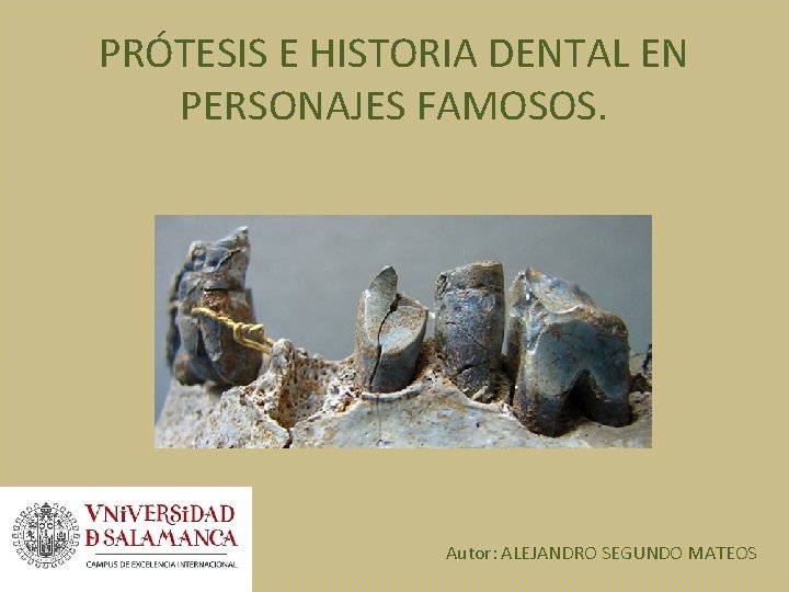 PRÓTESIS E HISTORIA DENTAL EN PERSONAJES FAMOSOS. Autor: ALEJANDRO SEGUNDO MATEOS 