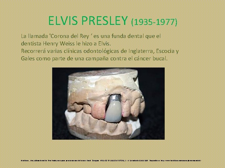 ELVIS PRESLEY (1935 -1977) La llamada 'Corona del Rey ‘ es una funda dental