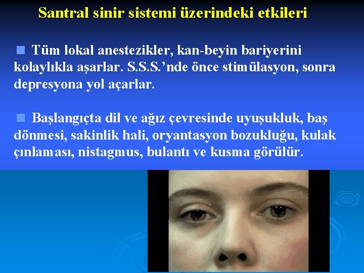Santral sinir sistemi üzerindeki etkileri < Tüm lokal anestezikler, kan-beyin bariyerini kolaylıkla aşarlar. S.