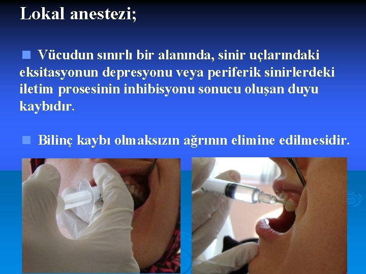 Lokal anestezi; < Vücudun sınırlı bir alanında, sinir uçlarındaki eksitasyonun depresyonu veya periferik sinirlerdeki