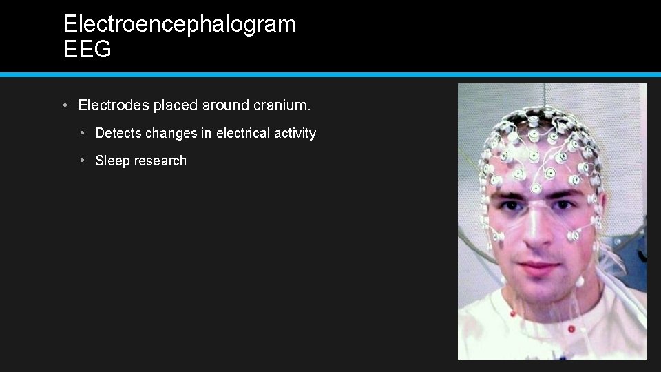 Electroencephalogram EEG • Electrodes placed around cranium. • Detects changes in electrical activity •