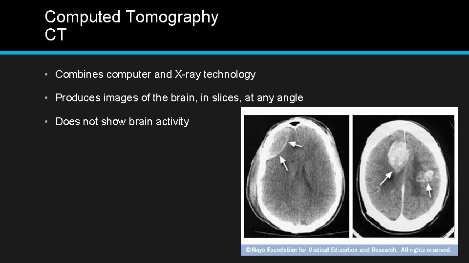 Computed Tomography CT • Combines computer and X-ray technology • Produces images of the