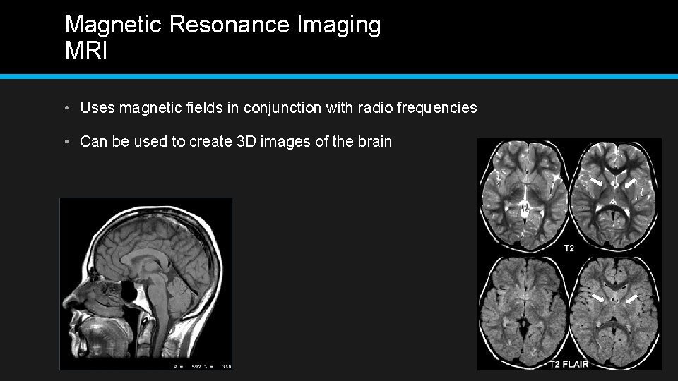 Magnetic Resonance Imaging MRI • Uses magnetic fields in conjunction with radio frequencies •