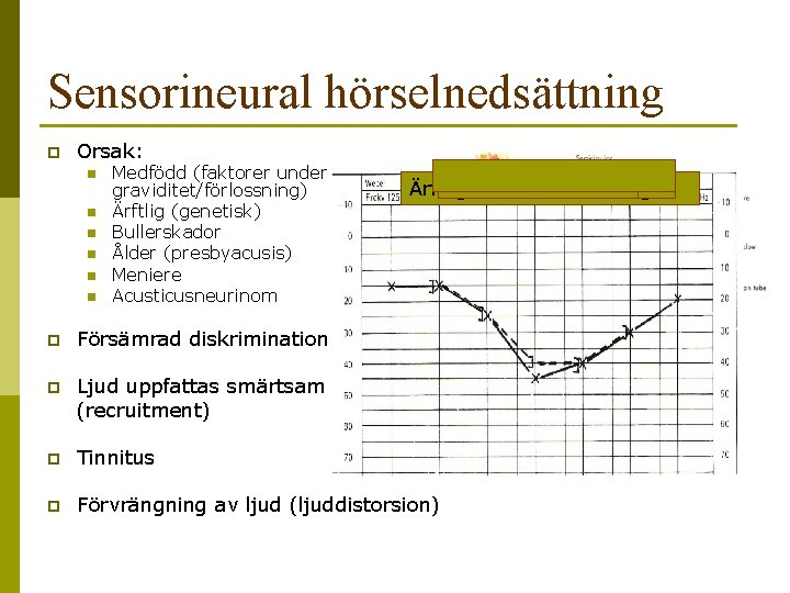 Sensorineural hörselnedsättning p Orsak: n n n Medfödd (faktorer under graviditet/förlossning) Ärftlig (genetisk) Bullerskador