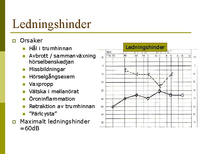 Ledningshinder p Orsaker n n n n n p Hål i trumhinnan Avbrott /