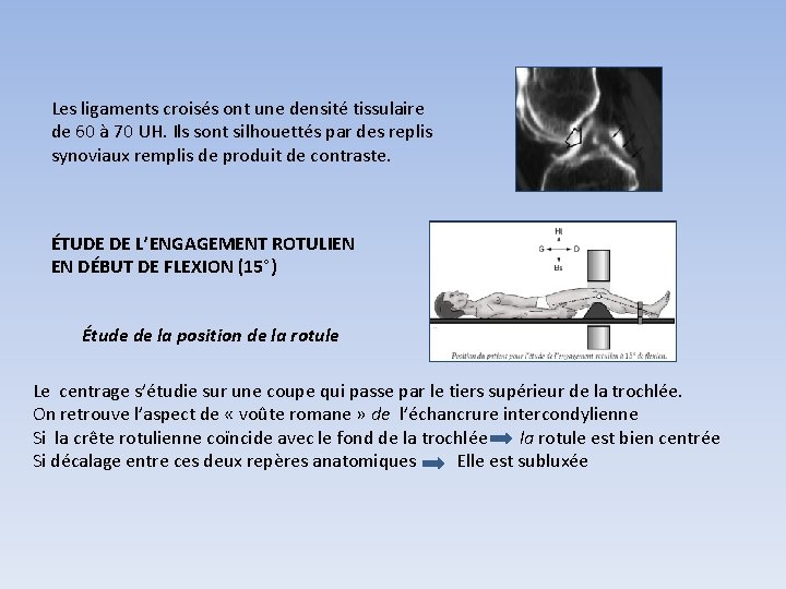 Les ligaments croisés ont une densité tissulaire de 60 à 70 UH. Ils sont Les ligaments croisés ont une densité tissulaire de 60 à 70 UH. Ils sont