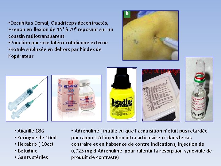 • Décubitus Dorsal, Quadriceps décontractés, • Genou en flexion de 15° à 20° • Décubitus Dorsal, Quadriceps décontractés, • Genou en flexion de 15° à 20°