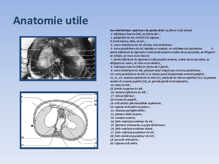 Anatomie utile Vue anatomique supérieure du genou droit. Le fémur a été enlevé. 1. Anatomie utile Vue anatomique supérieure du genou droit. Le fémur a été enlevé. 1.
