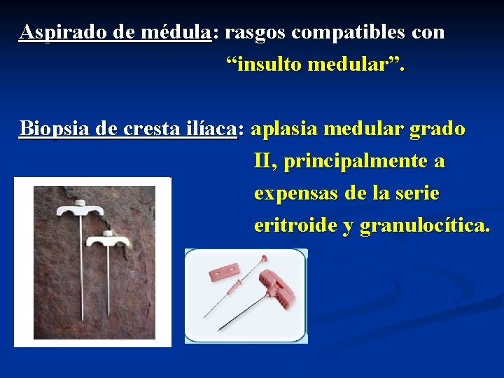 Aspirado de médula: rasgos compatibles con “insulto medular”. Biopsia de cresta ilíaca: aplasia medular